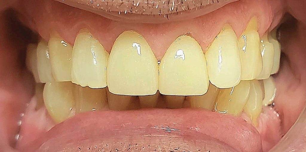 Medford Cosmetic Dentist Case 1 1 After