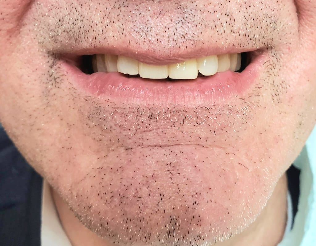 Medford Cosmetic Dentist Case 1 2 After