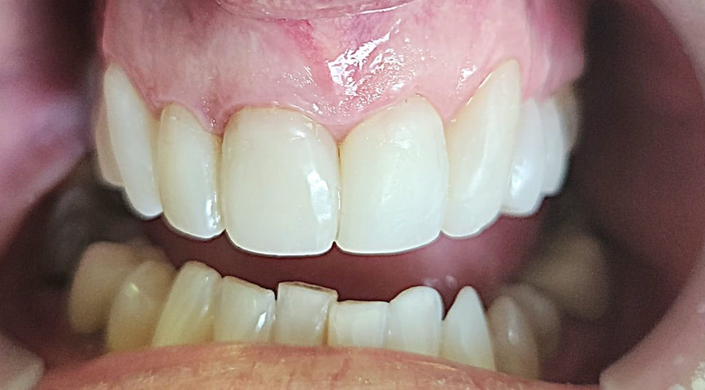 Medford Cosmetic Dentist Case 10 2 After