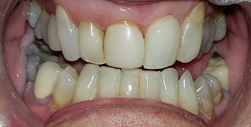 Medford Cosmetic Dentist Case 10 2 Before