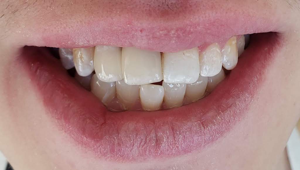 Medford Cosmetic Dentist Case 11 1 After