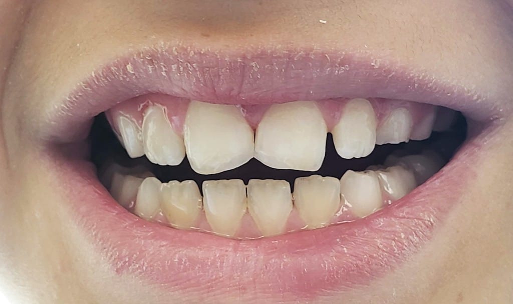 Medford Cosmetic Dentist Case 13 1 After