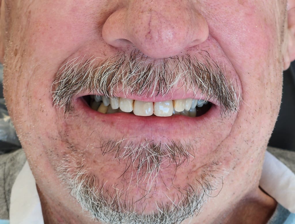Medford Cosmetic Dentist Case 14 1 After