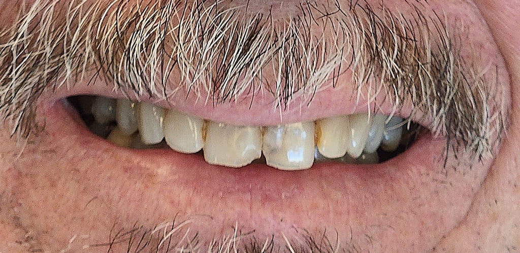 Medford Cosmetic Dentist Case 14 2 Before
