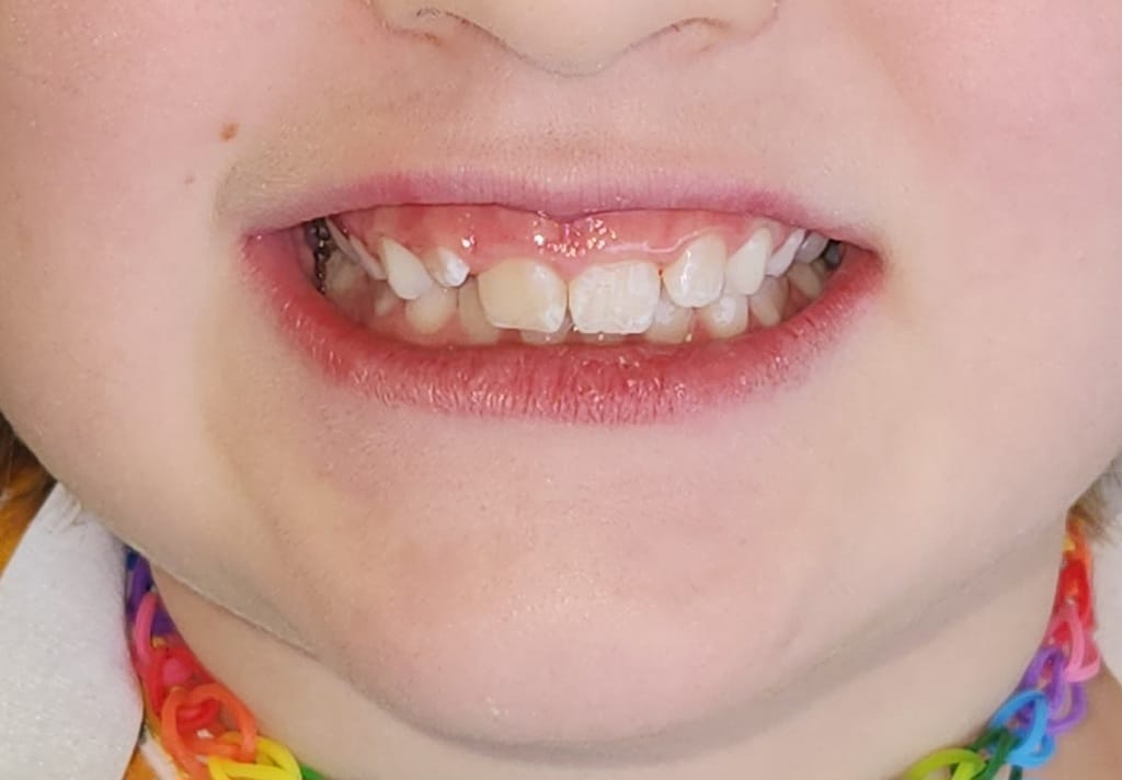 Medford Cosmetic Dentist Case 15 1 After
