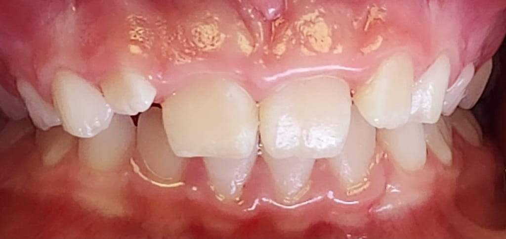 Medford Cosmetic Dentist Case 15 2 After