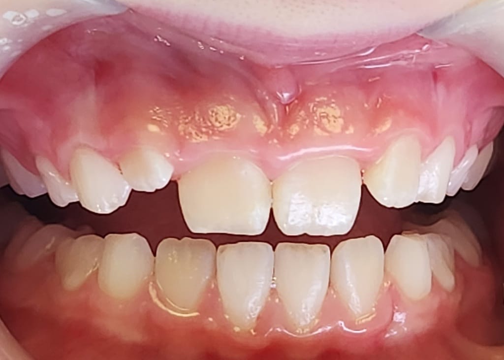 Medford Cosmetic Dentist Case 15 2 Before