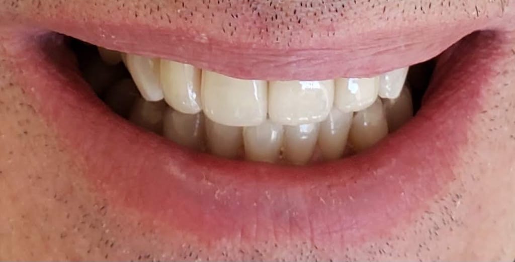 Medford Cosmetic Dentist Case 16 2 After