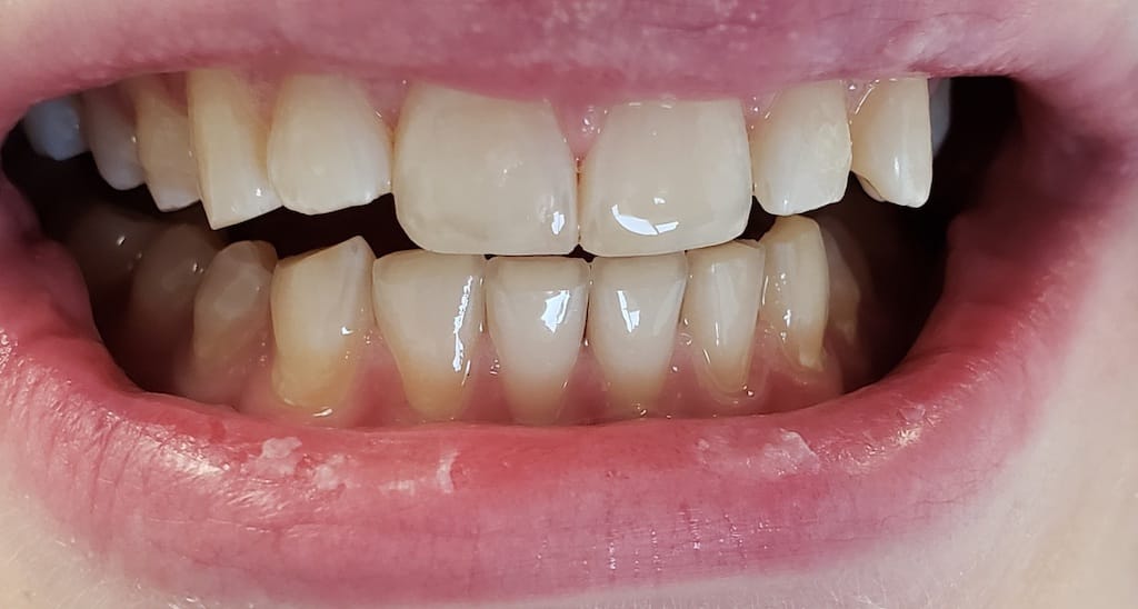 Medford Cosmetic Dentist Case 17 1 After