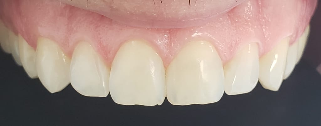 Medford Cosmetic Dentist Case 2 2 After