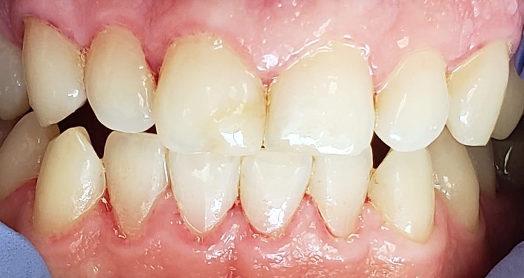 Medford Cosmetic Dentist Case 3 1 After
