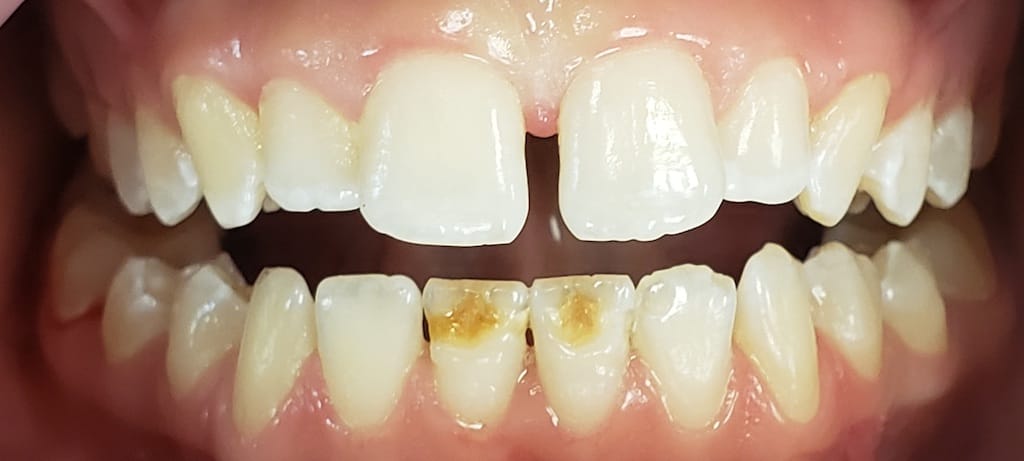 Medford Cosmetic Dentist Case 5 1 Before