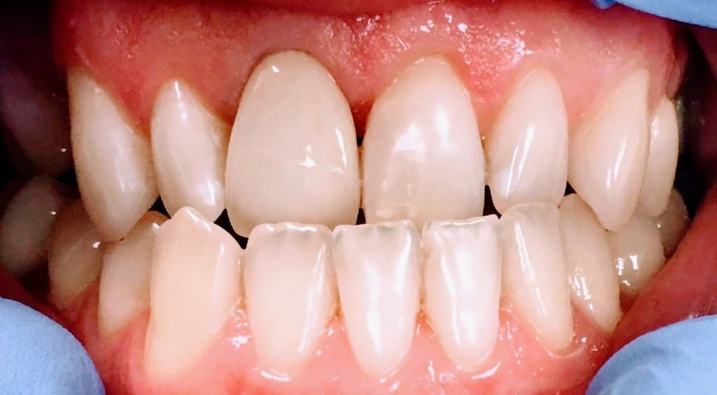 Medford Cosmetic Dentist Case 6 2 After