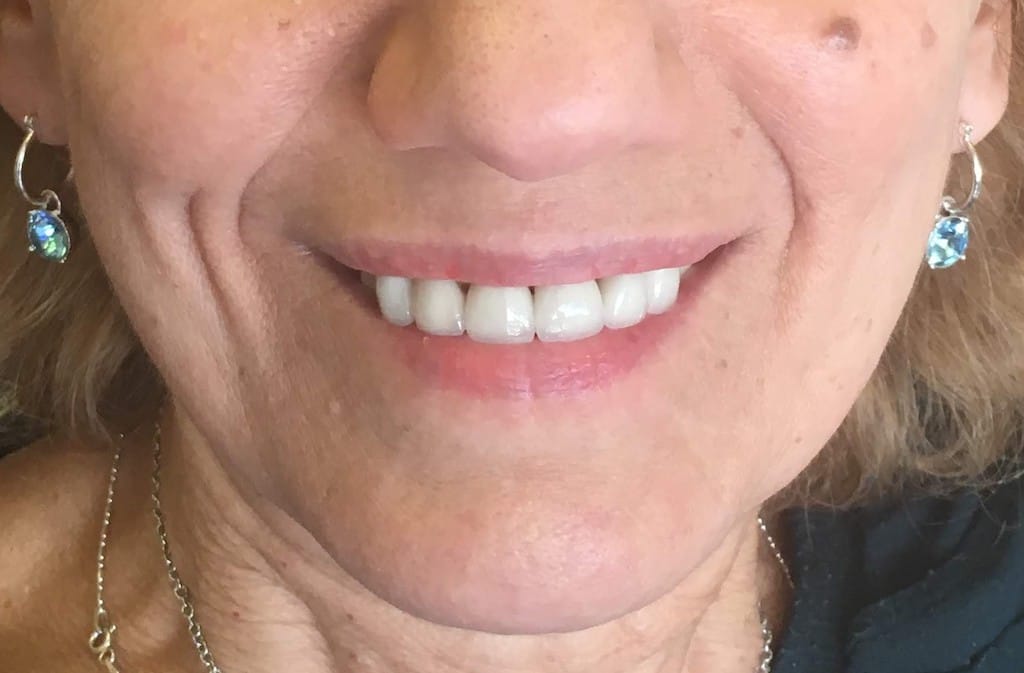 Medford Cosmetic Dentist Case 7 1 After