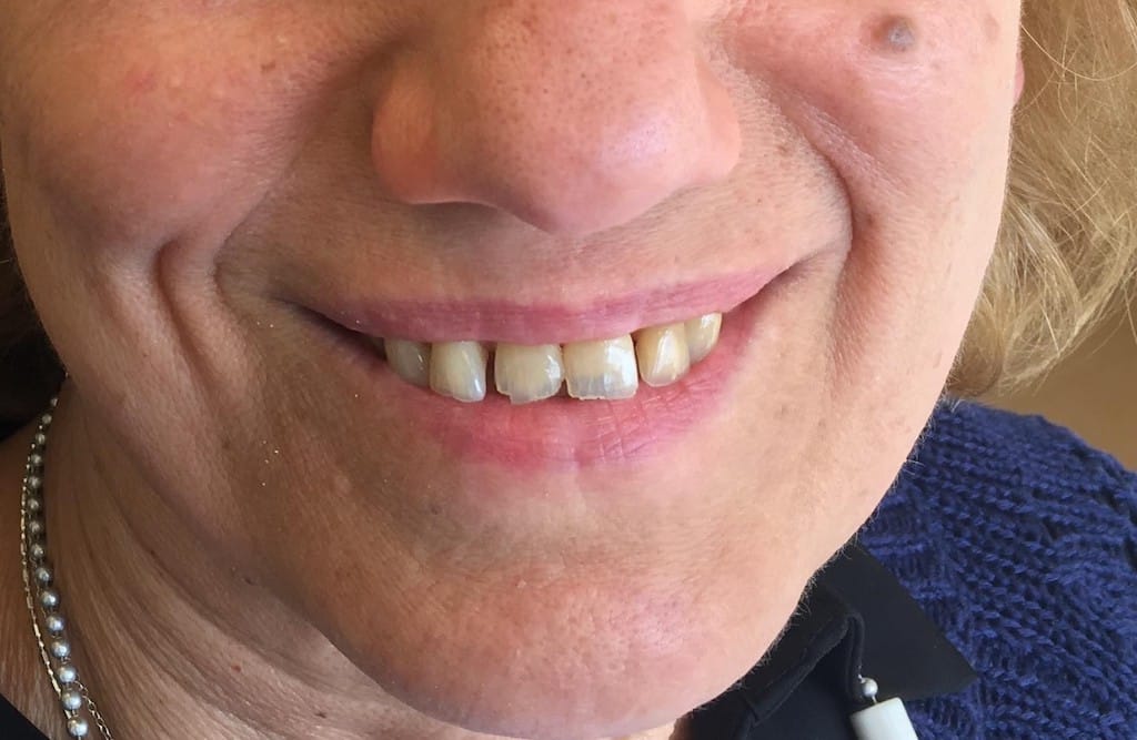 Medford Cosmetic Dentist Case 7 1 Before