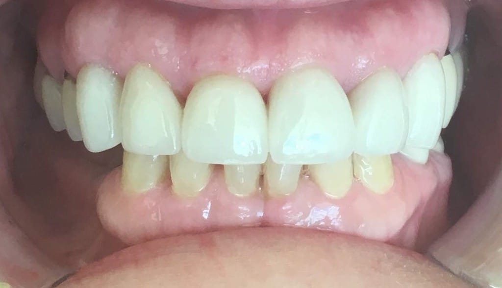 Medford Cosmetic Dentist Case 7 2 After
