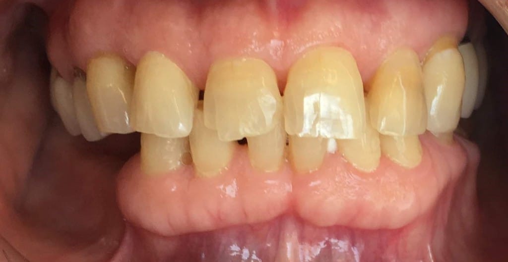 Medford Cosmetic Dentist Case 7 2 Before