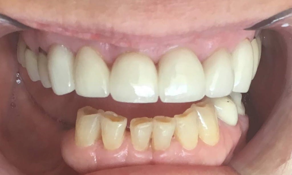 Medford Cosmetic Dentist Case 7 3 After