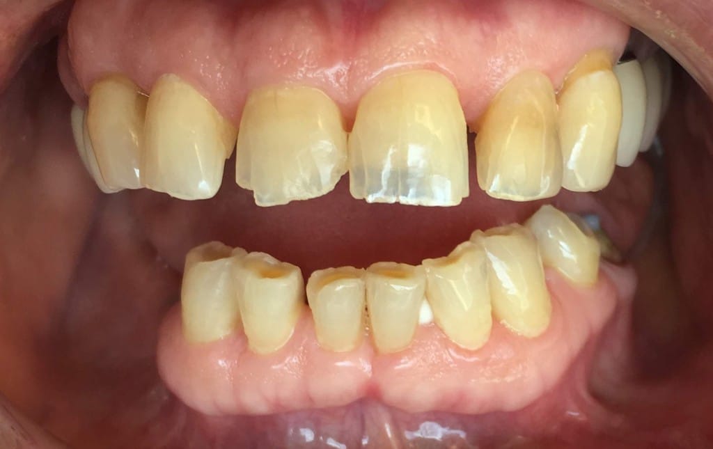 Medford Cosmetic Dentist Case 7 3 Before
