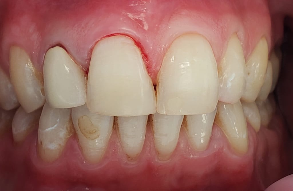 Medford Cosmetic Dentist Case 8 1 After
