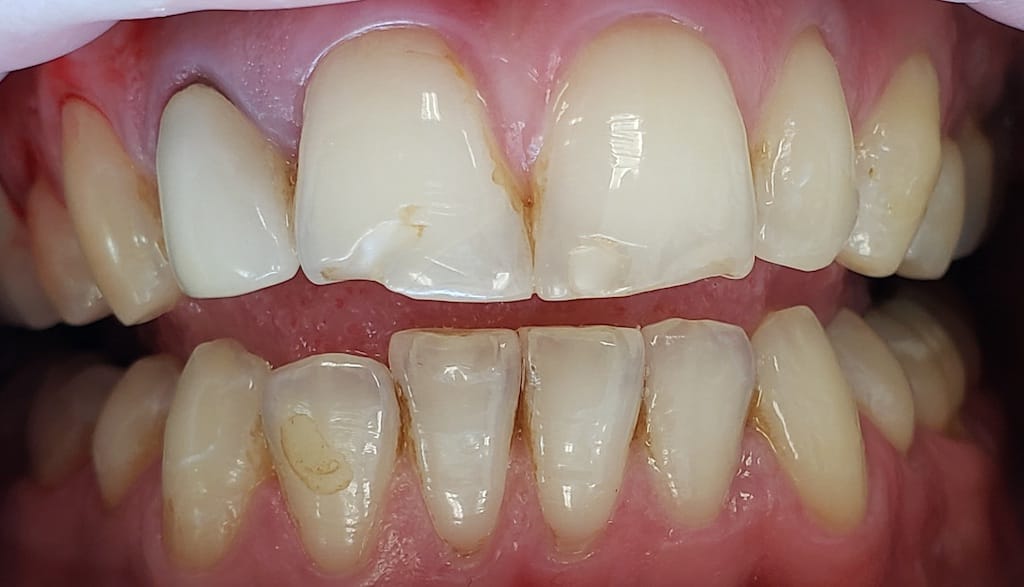 Medford Cosmetic Dentist Case 8 1 Before