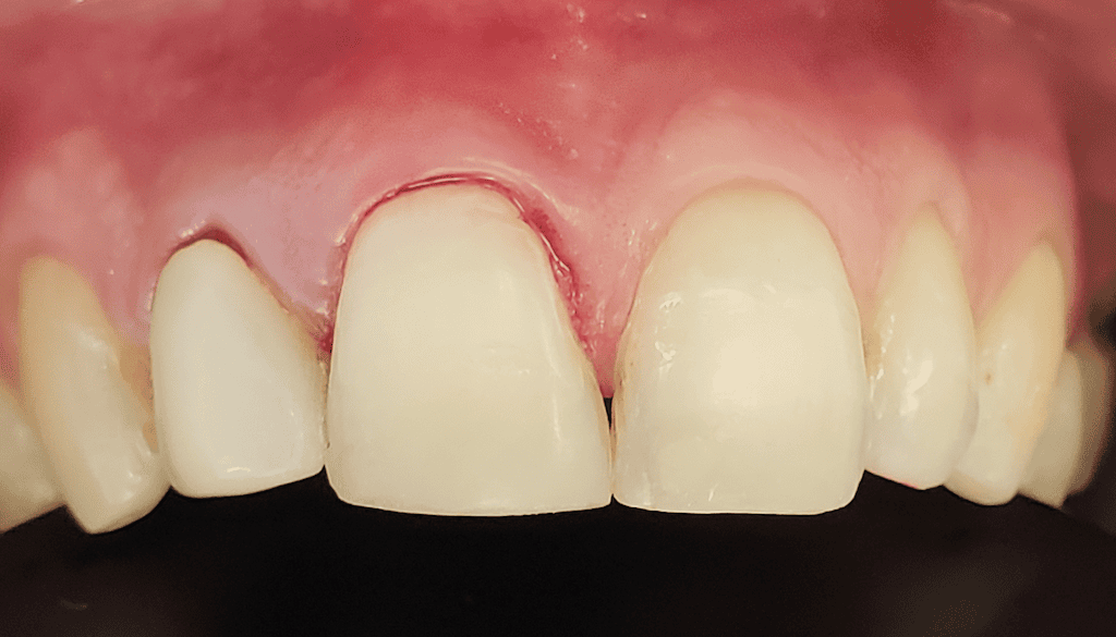 Medford Cosmetic Dentist Case 8 2 After