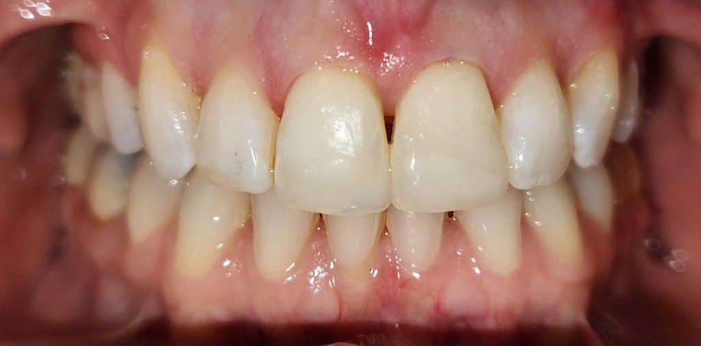 Medford Cosmetic Dentist Case 9 1 After