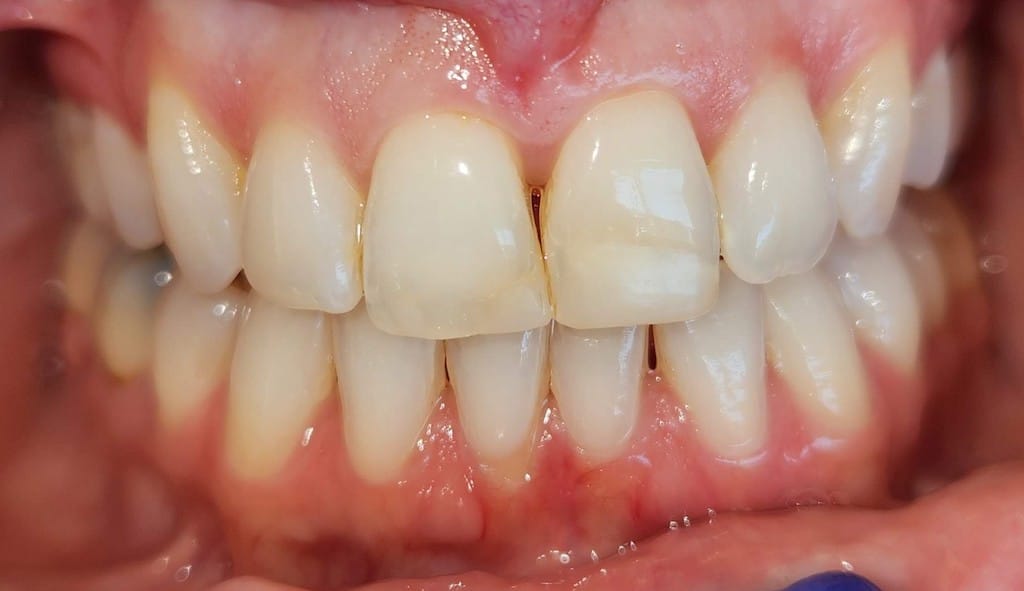 Medford Cosmetic Dentist Case 9 1 Before