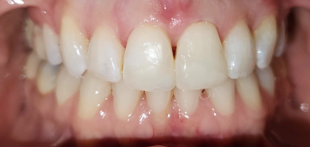 Medford Cosmetic Dentist Case 9 2 After