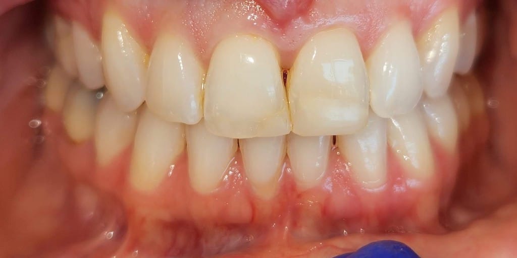 Medford Cosmetic Dentist Case 9 2 Before